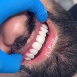 کلینیک دندانپزشکی کاریزما طرف قرارداد با بیمه تکمیلی در کرمان دکتر اسماء پیش بین