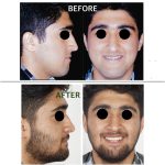dr-ghasemi-omfs (1)