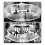 dr-ghasemi-omfs (2)