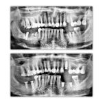 dr-ghasemi-omfs (3)