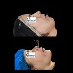 dr-ghasemi-omfs (5)