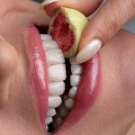 dr-fatemeh-foroozesh-implant-cosmetic-dentist-tehran (10)