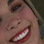 dr-fatemeh-foroozesh-implant-cosmetic-dentist-tehran (7)